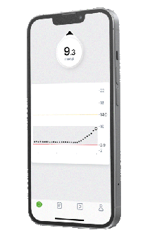 Mobile-trend-high_smaller