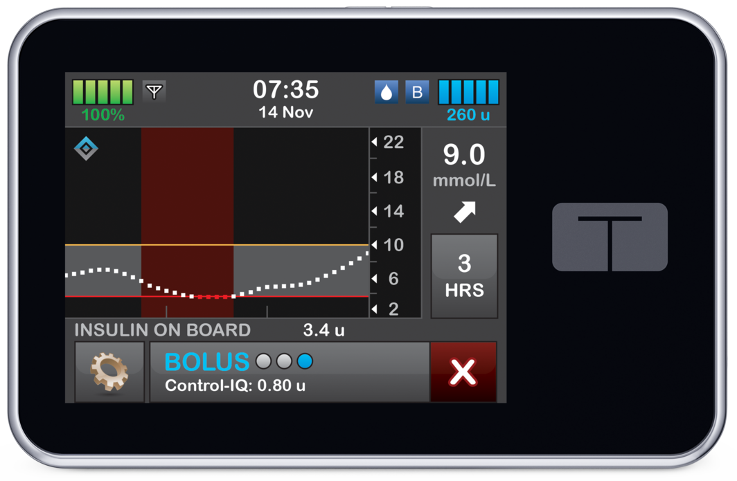 Front-Straight-View - ENI-MMOL-CIQ-Home-Hero Bolus-1